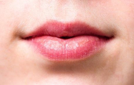 Wrinkles Above the Lips: The Best Treatments & Prevention